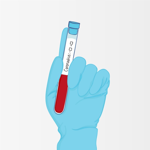 Examen de sangre de coronavirus