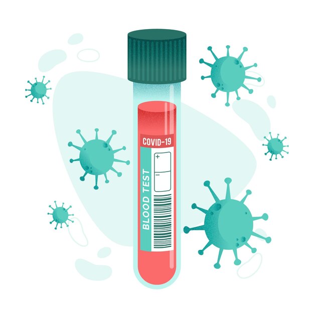 Examen de sangre de coronavirus