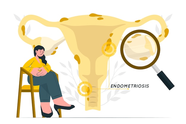 Vector gratuito ilustración del concepto de endometriosis