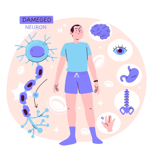Ilustración del concepto de esclerosis múltiple