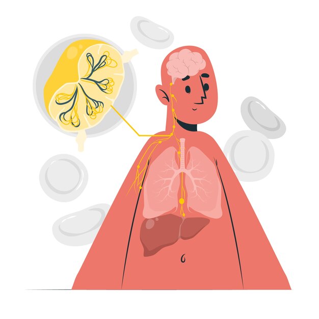 Ilustración del concepto de linfoma