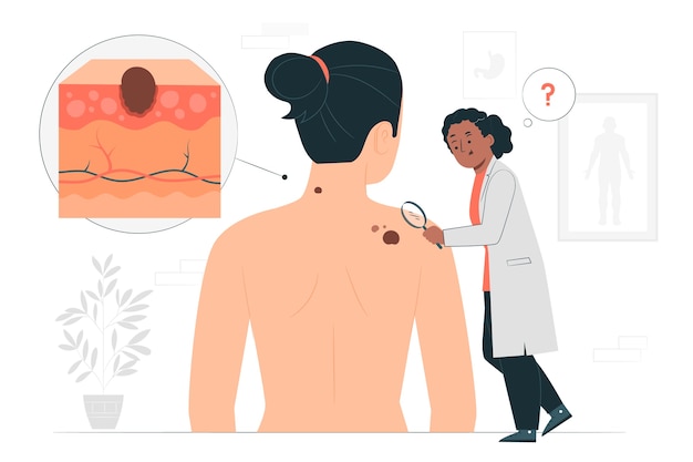 Vector gratuito ilustración del concepto de melanoma