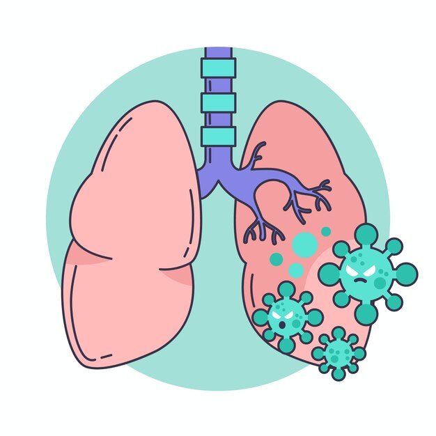 Ilustración de la neumonía por coronavirus