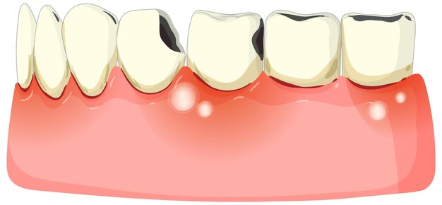 Ilustración de la salud de las encías y los dientes