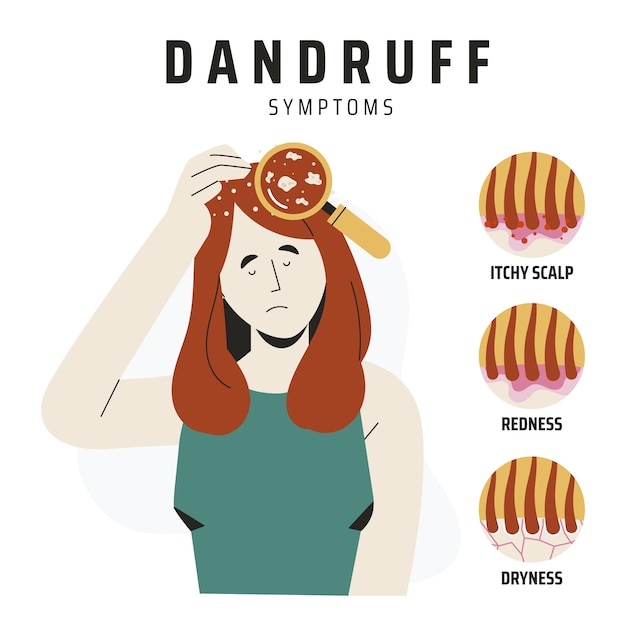 Vector gratuito infografía de caspa dibujada a mano
