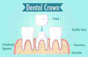 Vector gratuito infografía de humano en corona dental.