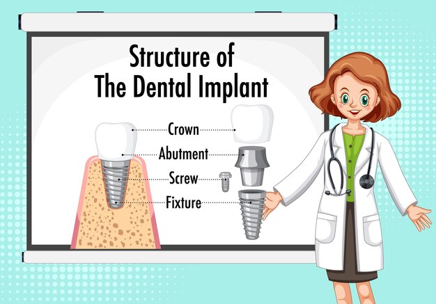Infografía de humanos en la estructura del implante dental.