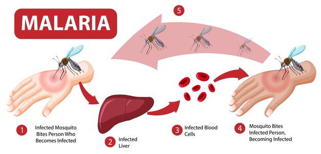 Infografía de información de síntomas de malaria