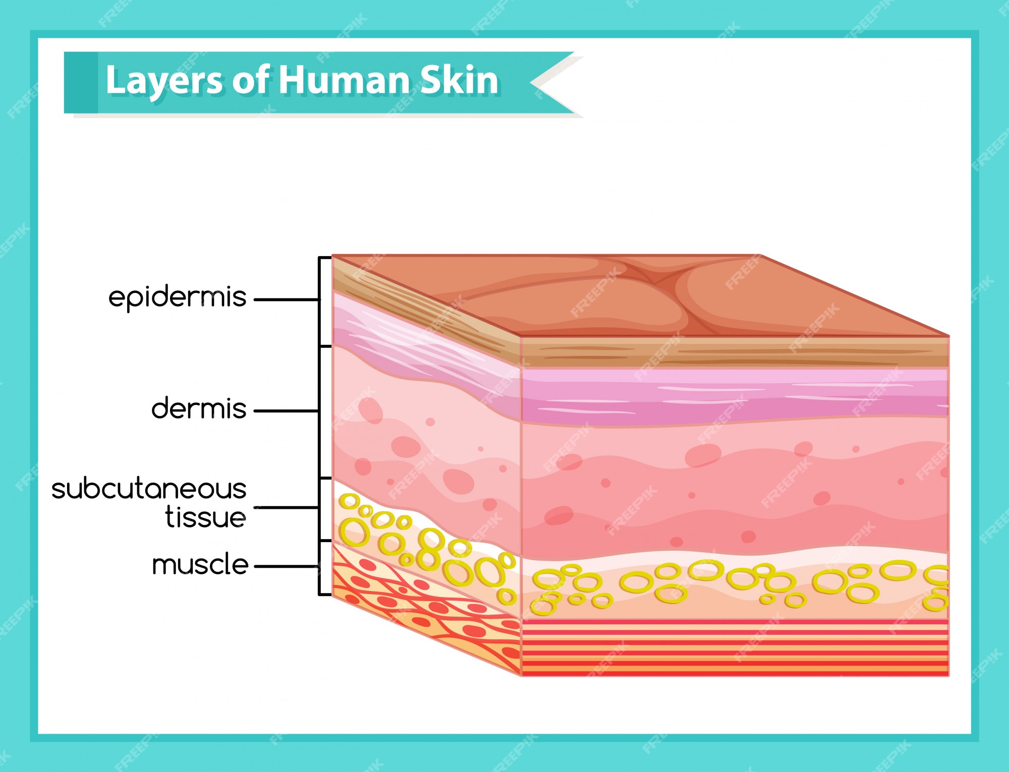 Some type of skin