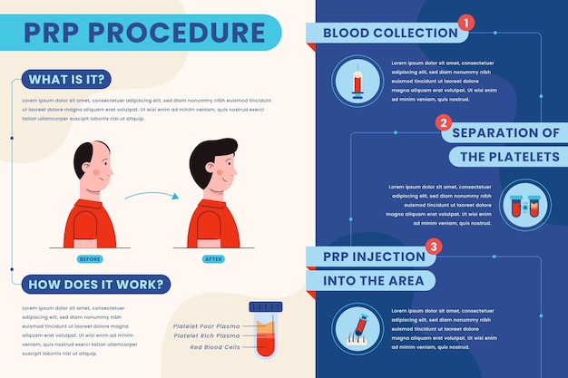 Infografía de procedimiento prp dibujado a mano plana