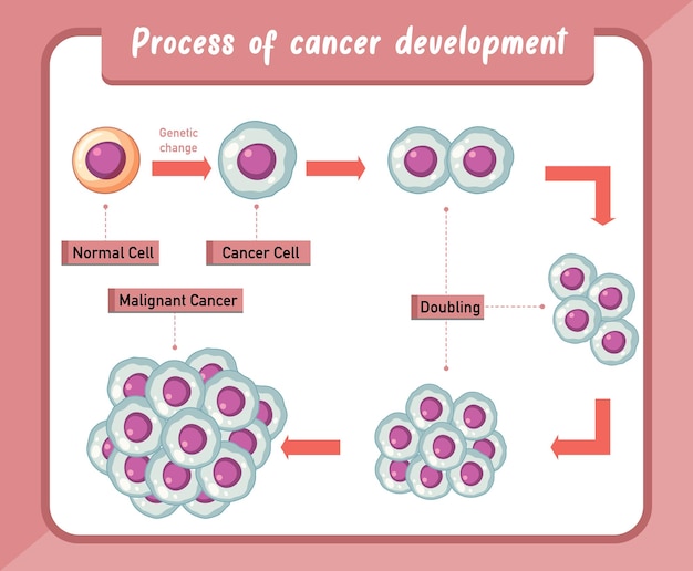 Infografía del proceso de desarrollo del cáncer.