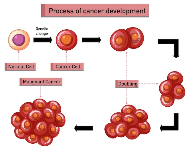 Infografía del proceso de desarrollo del cáncer.