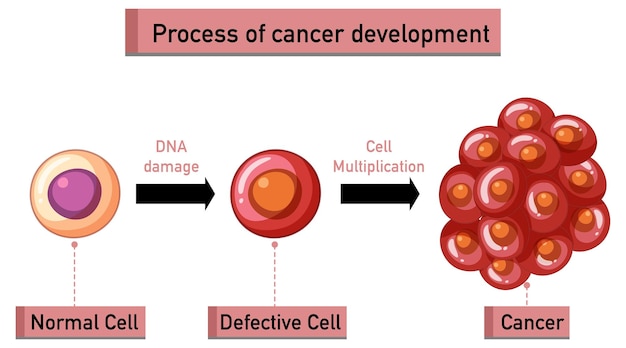 Vector gratuito infografía del proceso de desarrollo del cáncer.