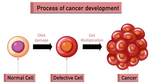 Infografía del proceso de desarrollo del cáncer.