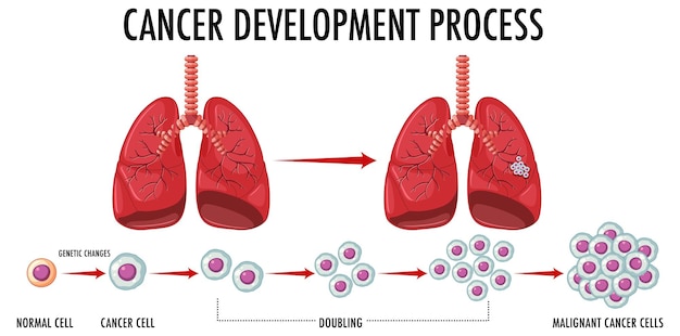 Vector gratuito infografía del proceso de desarrollo del cáncer.