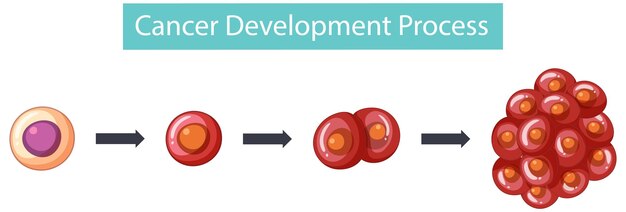 Vector gratuito infografía del proceso de desarrollo del cáncer.