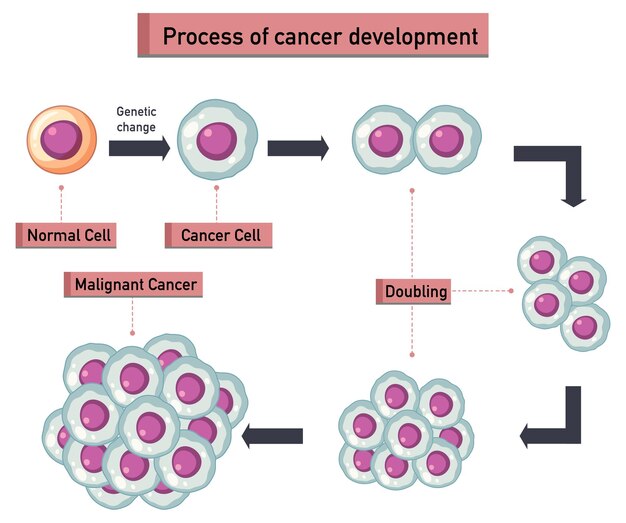 Infografía del proceso de desarrollo del cáncer.
