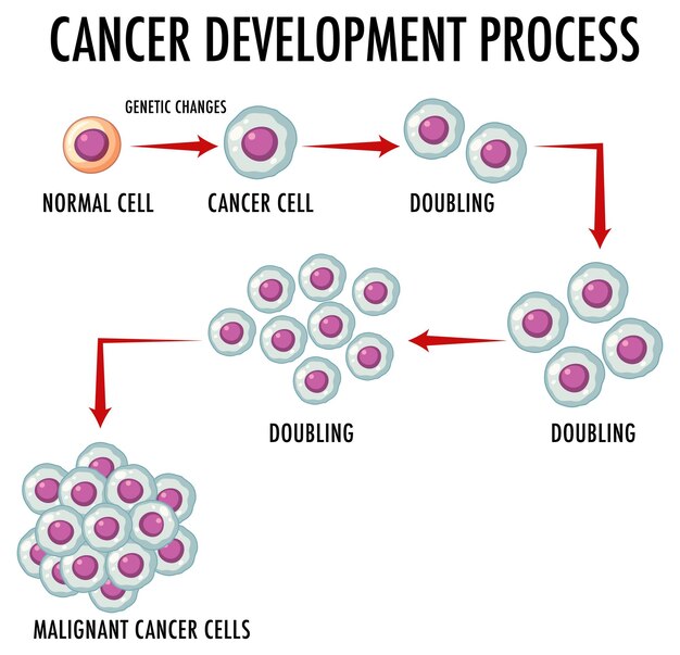 Infografía del proceso de desarrollo del cáncer