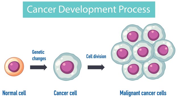 Infografía del proceso de desarrollo del cáncer