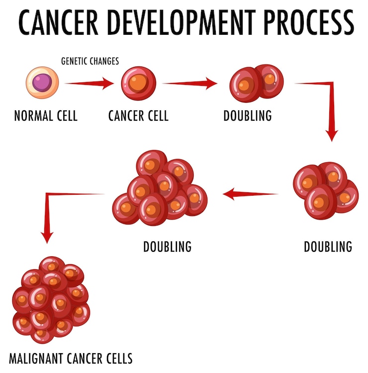 Vector gratuito infografía del proceso de desarrollo del cáncer.
