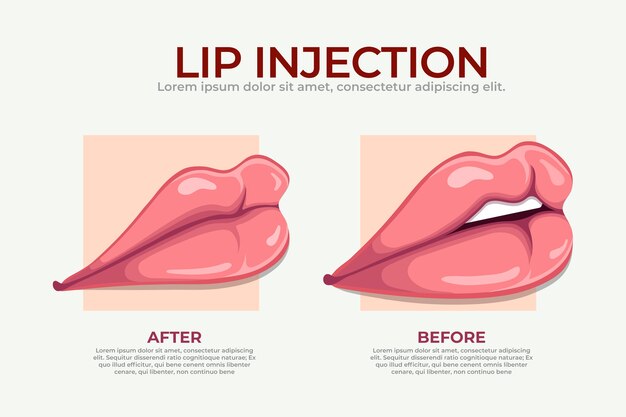 Infografía de relleno de labios dibujada a mano