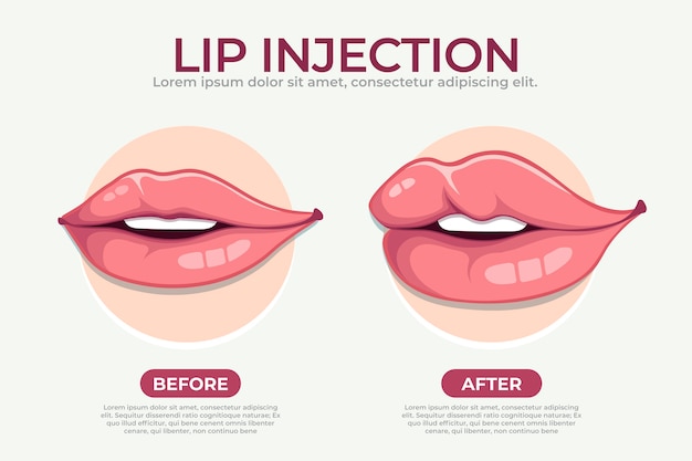 Vector gratuito infografía de relleno de labios dibujada a mano