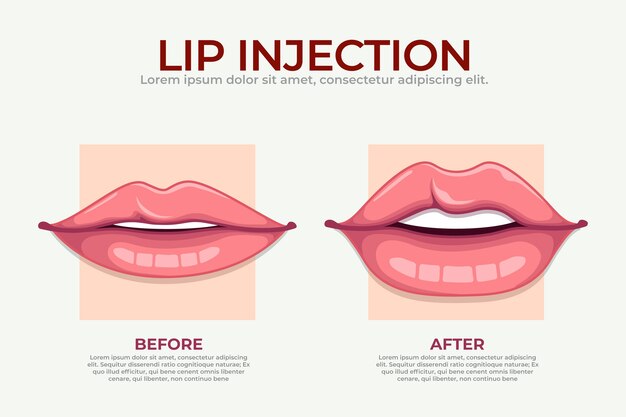 Infografía de relleno de labios dibujada a mano