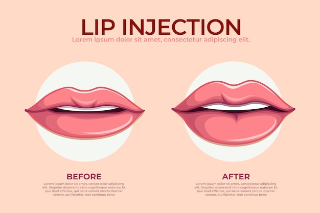 Vector gratuito infografía de relleno de labios dibujada a mano