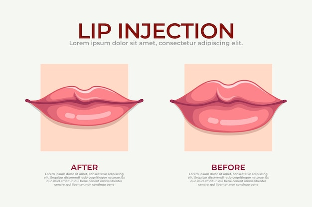 Infografía de relleno de labios dibujada a mano