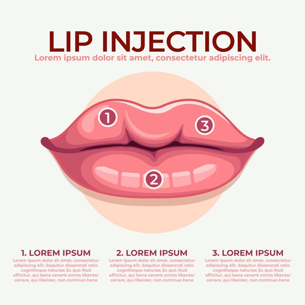 Infografía de relleno de labios dibujada a mano