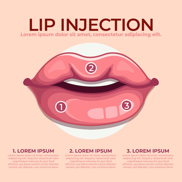 Infografía de relleno de labios dibujada a mano