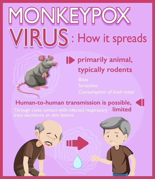 Infografía de síntomas del virus de la viruela del mono