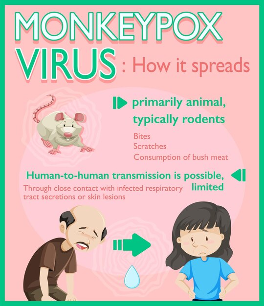 Infografía de síntomas del virus de la viruela del mono