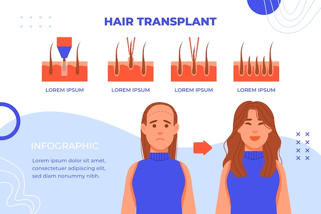 Infografía de trasplante capilar dibujada a mano