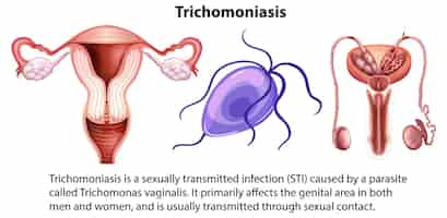 Vector gratuito infografía de tricomoniasis con explicación.