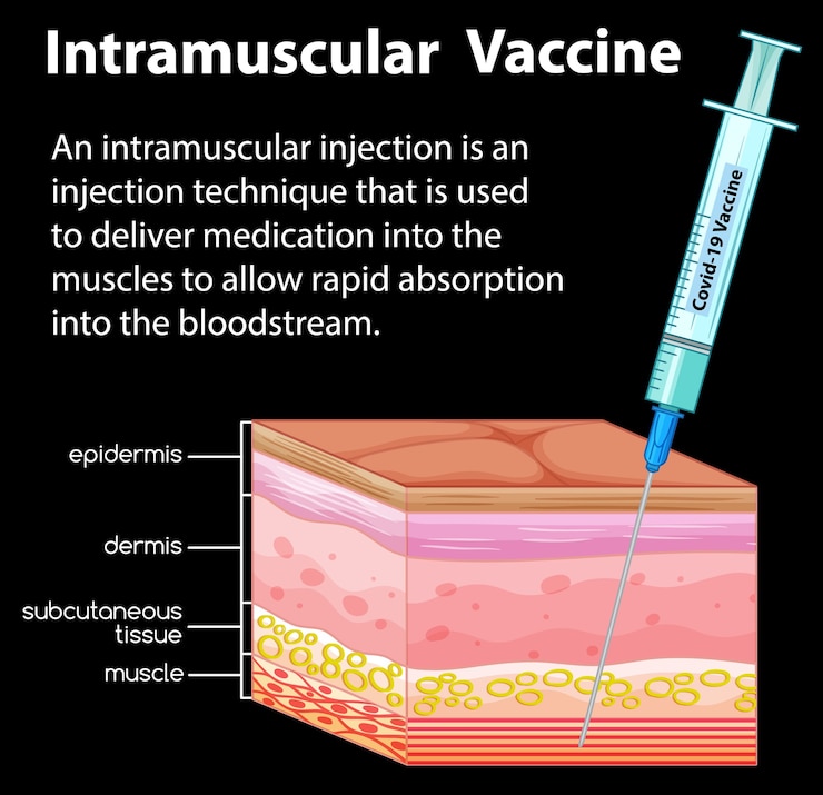 Vector gratuito información sobre inyección intramuscular