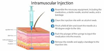 Vector gratuito inyección intramuscular con explicación