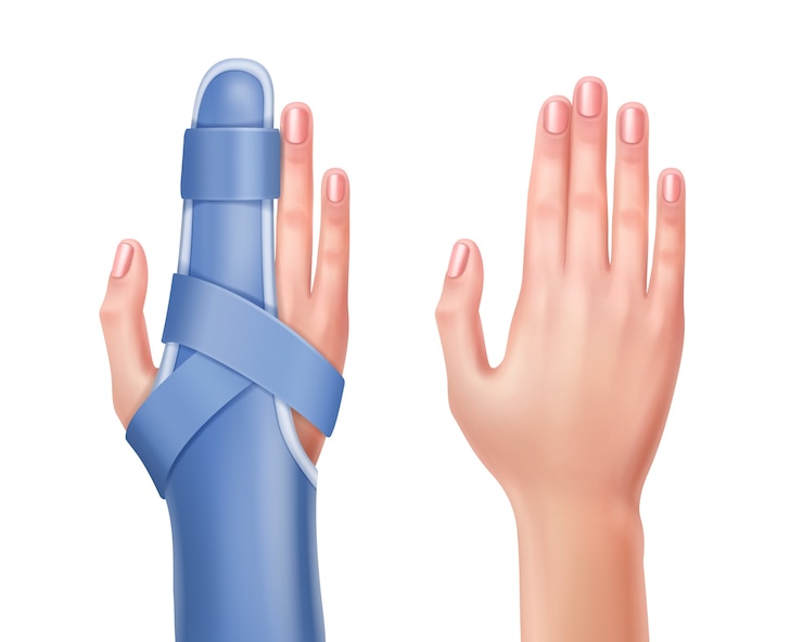Vector gratuito mano vacía y trauma de mano con dedo en férula