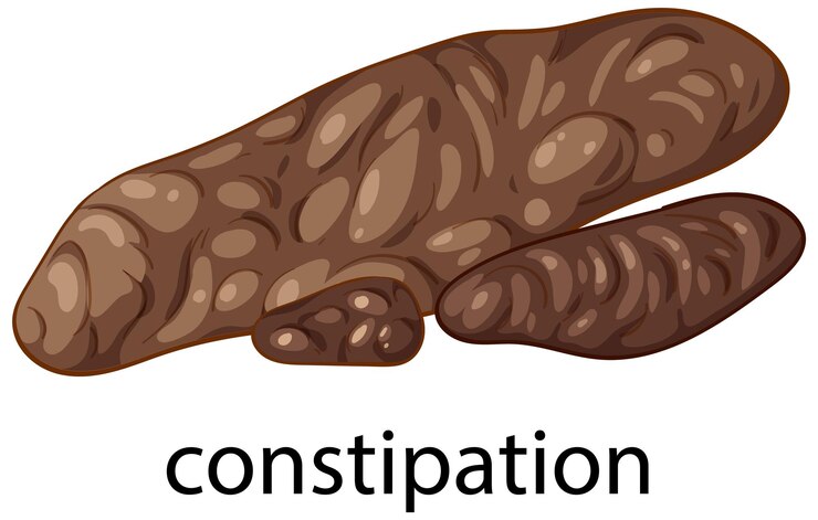 Vector gratuito medical illustration of constipation symptoms
