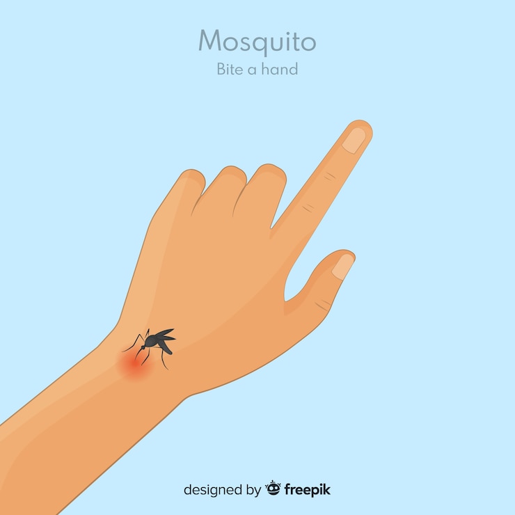 Vector gratuito mosquito picando en una mano dibujado a mano