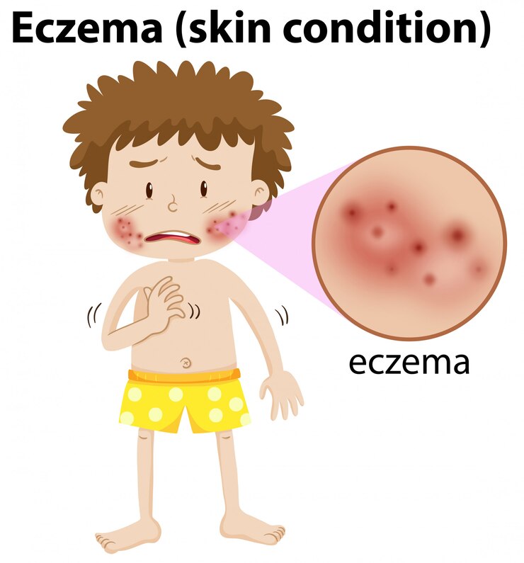 Vector gratuito un muchacho joven que tiene eczema