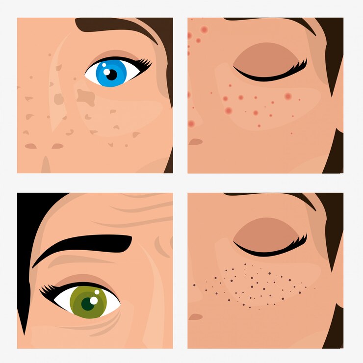 Vector gratuito mujer antes y después del tratamiento de la piel.