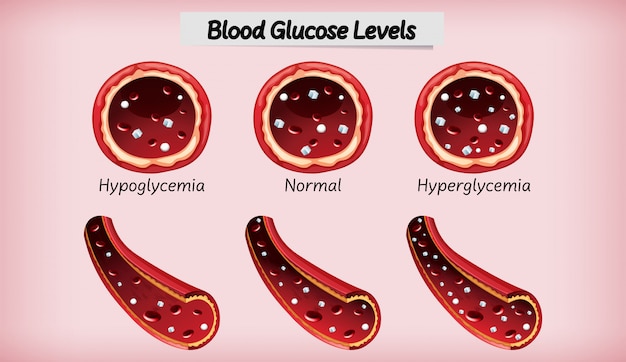 Nivel médico de glucosa en sangre