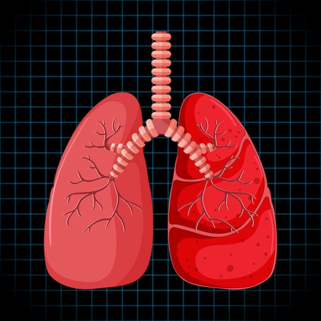 Vector gratuito Órgano interno humano con pulmones