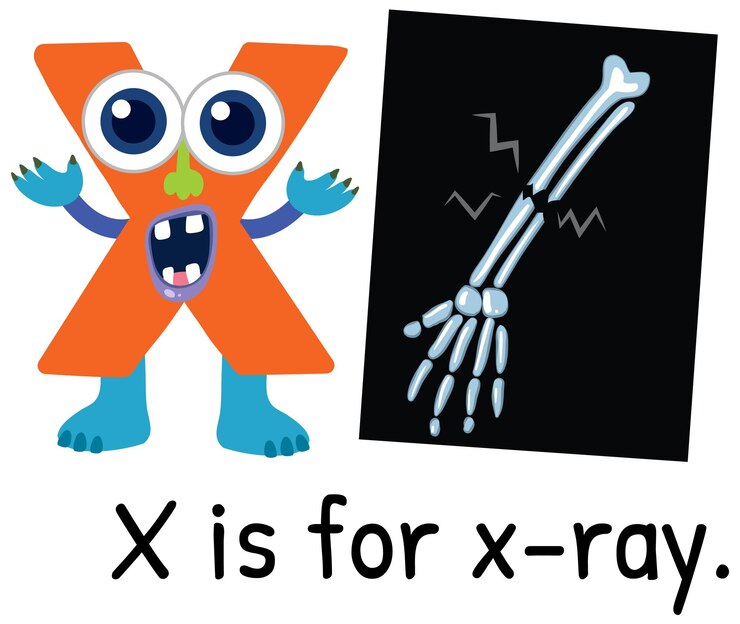 Vector gratuito playful alphabet x with xray illustration