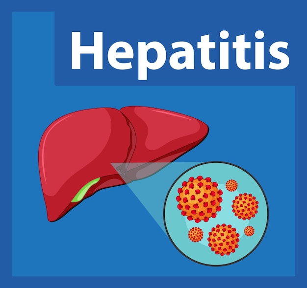 Vector gratuito primer plano de la célula del virus de la hepatitis en la anatomía del hígado humano