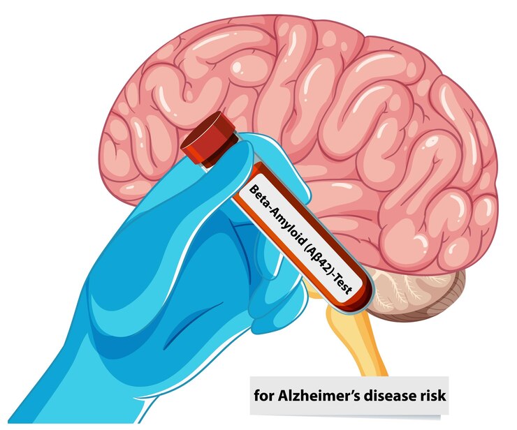 Vector gratuito prueba de beta amiloide para el riesgo de alzheimer
