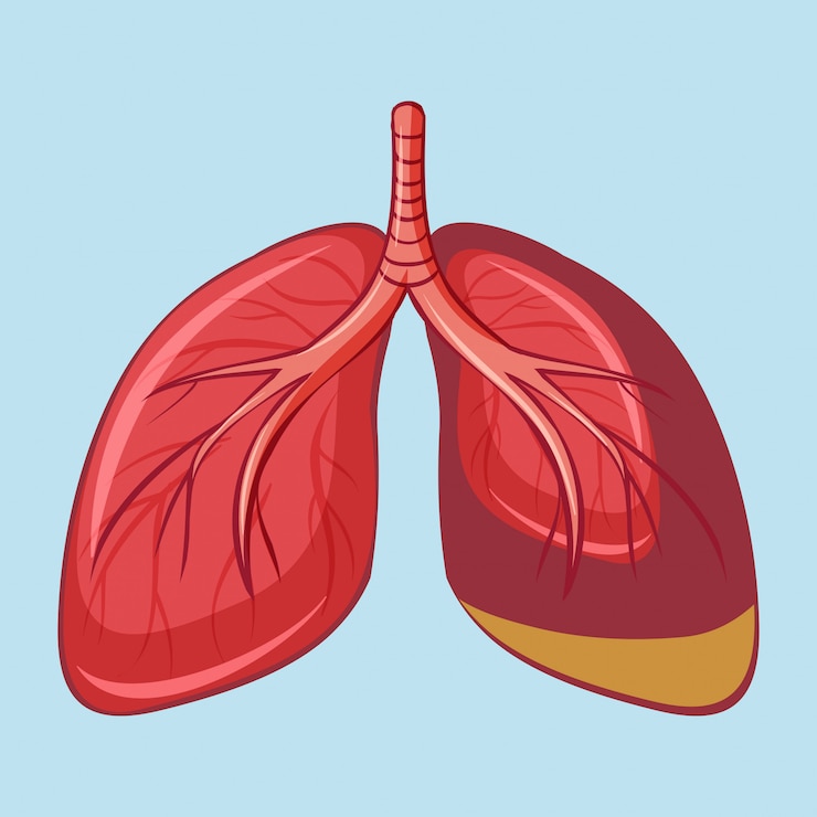 Vector gratuito pulmón humano con mesotelioma pleural