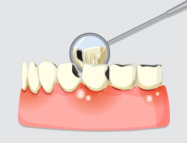 Revisión dental con la herramienta del espejo