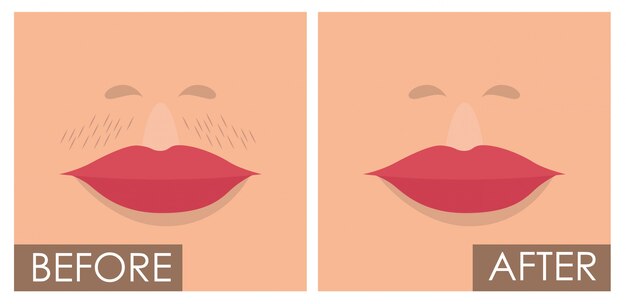 Rostro de mujer antes y después de la depilación.